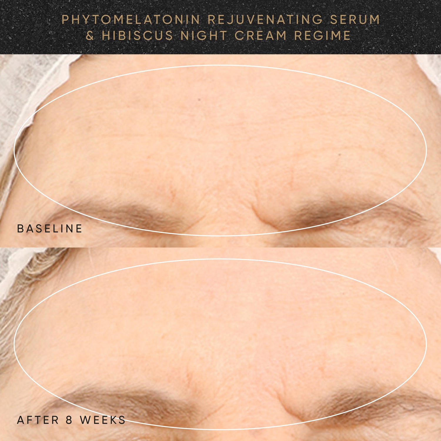 Wrinkle-Smoothing PM Travel-Size Kit