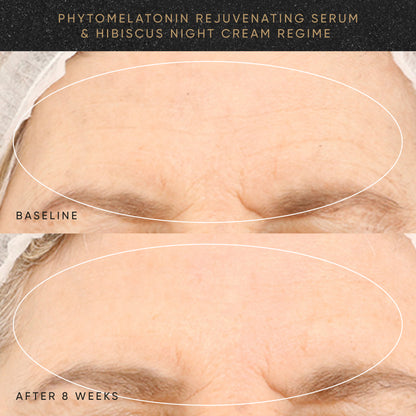 Before and after comparison of a woman&